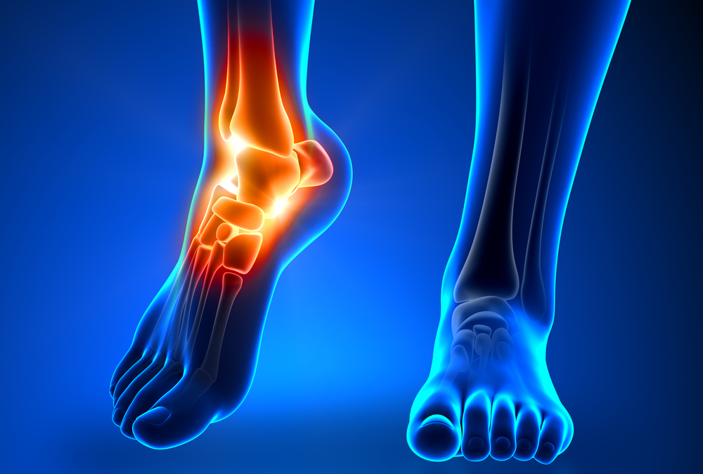 13 Types of Foot and Ankle Injuries That Shouldn’t Be Ignored