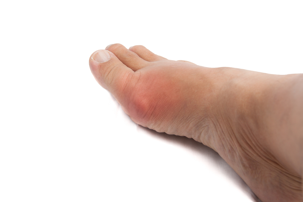How Do You Get Rid of Pain in Your Big Toe?